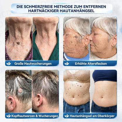 𝐏𝐢𝐜𝐝𝐨® 𝟕-𝐓𝐚𝐠𝐞 𝐇𝐚𝐮𝐭𝐚𝐧𝐡ä𝐧𝐠𝐬𝐞𝐥- & 𝐅𝐥𝐞𝐜𝐤𝐞𝐧-𝐄𝐧𝐭𝐟𝐞𝐫𝐧𝐮𝐧𝐠𝐬𝐜𝐫𝐞𝐦𝐞(𝐒𝐜𝐡𝐦𝐞𝐫𝐳𝐟𝐫𝐞𝐢𝐞 𝐅𝐨𝐫𝐦𝐞𝐥 – 𝐨𝐡𝐧𝐞 𝐍𝐚𝐫𝐛𝐞𝐧)🌟🌟🌟