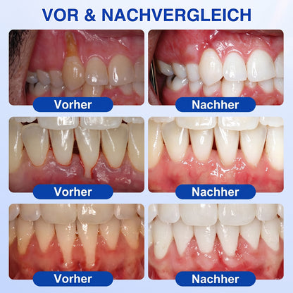 🇩🇪🏆🦷🛡️ Dr.Era® GumRevive Zahnfleisch- & Parodontalschutz-Gel🧊🧊🧊🧊🧊