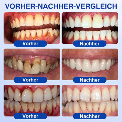 🇩🇪🏆🦷🛡️ Dr.Era® GumRevive Zahnfleisch- & Parodontalschutz-Gel🧊🧊🧊🧊🧊