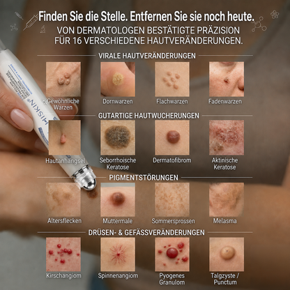 HISKIN®👩‍⚕️ 7-Tage-Hautmakel- & Hautanhängsel-Entferner Schmerzfreier Rollerball-Stift zur schonenden Entfernung von Hautanhängseln und Hautflecken – narbenfrei💛