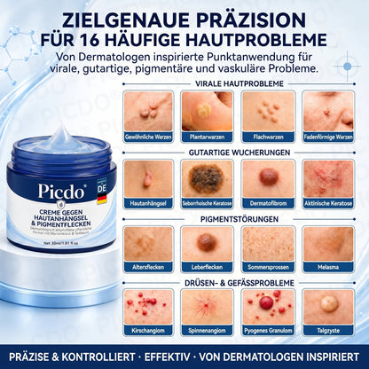 𝐏𝐢𝐜𝐝𝐨® 𝟕-𝐓𝐚𝐠𝐞 𝐇𝐚𝐮𝐭𝐚𝐧𝐡ä𝐧𝐠𝐬𝐞𝐥- & 𝐅𝐥𝐞𝐜𝐤𝐞𝐧-𝐄𝐧𝐭𝐟𝐞𝐫𝐧𝐮𝐧𝐠𝐬𝐜𝐫𝐞𝐦𝐞(𝐒𝐜𝐡𝐦𝐞𝐫𝐳𝐟𝐫𝐞𝐢𝐞 𝐅𝐨𝐫𝐦𝐞𝐥 – 𝐨𝐡𝐧𝐞 𝐍𝐚𝐫𝐛𝐞𝐧)🌟🌟🌟