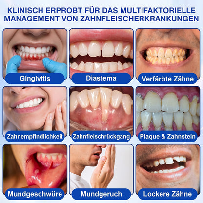 🇩🇪🏆🦷🛡️ Dr.Era® GumRevive Zahnfleisch- & Parodontalschutz-Gel🧊🧊🧊🧊🧊