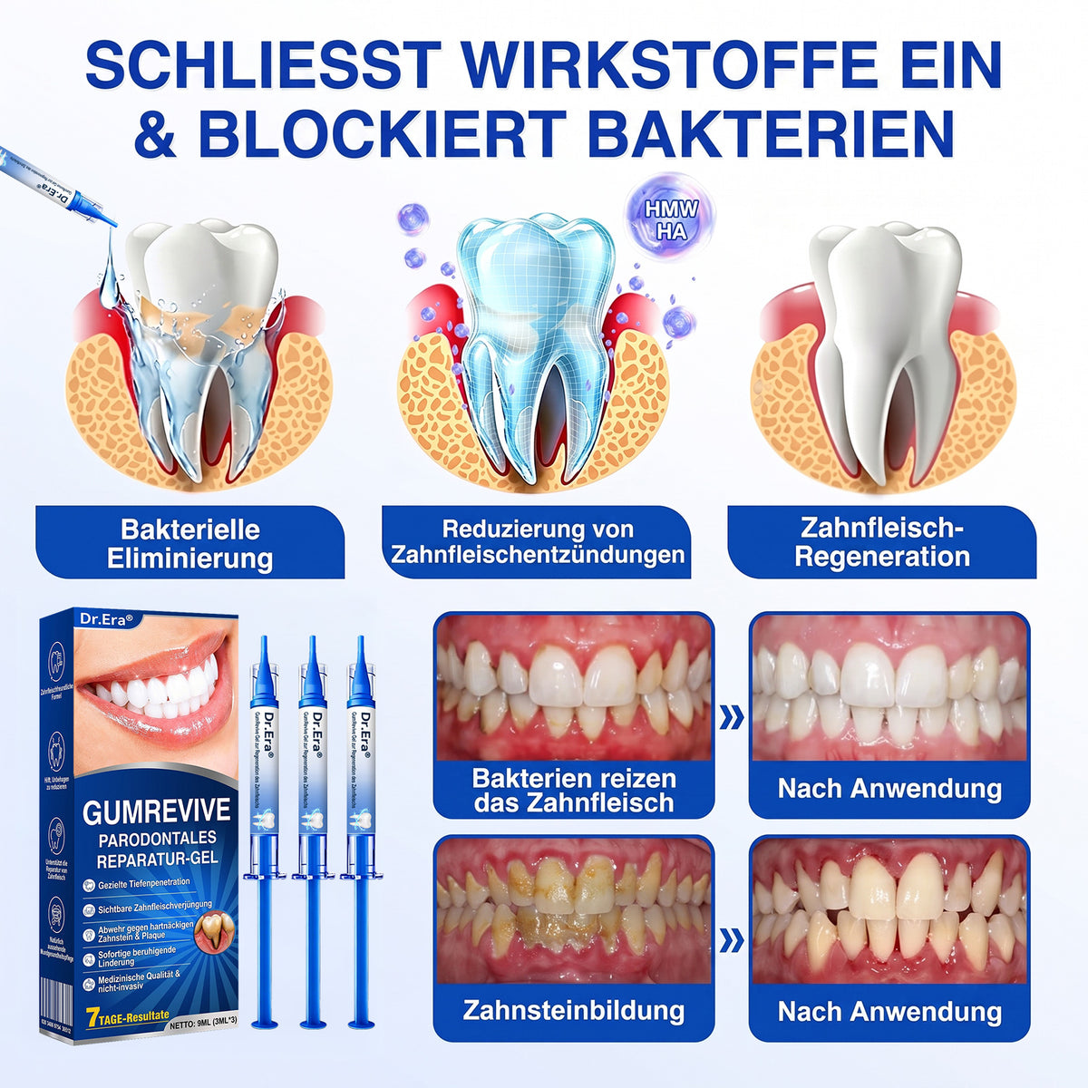 🇩🇪🏆🦷🛡️ Dr.Era® GumRevive Zahnfleisch- & Parodontalschutz-Gel🧊🧊🧊🧊🧊